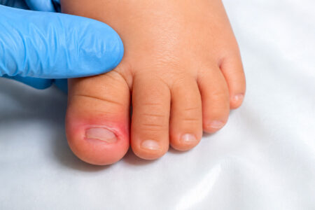 Podologia Pediatrica